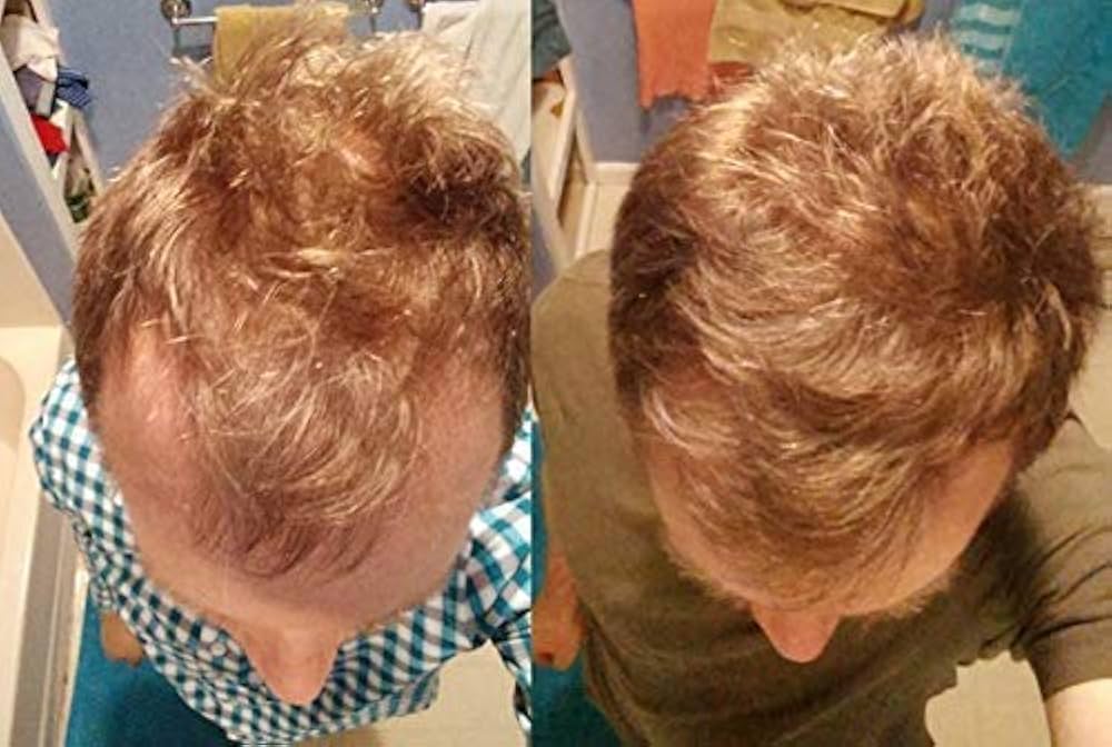 Built for the scalp, not just the hair